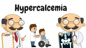 Hypercalcemia Treatment